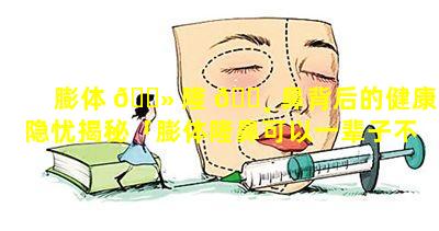 膨体 🌻 隆 🕸 鼻背后的健康隐忧揭秘「膨体隆鼻可以一辈子不取出来吗」